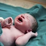 Complications, concerns, loss, birth, unexpected, unplanned, deformities