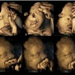4d scan, grimace, foetus, smoke, cigarette, smoking